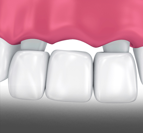 Treatment - Kettering Dental