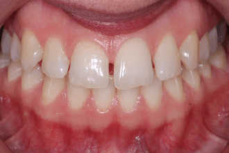 Before - Kettering Dental