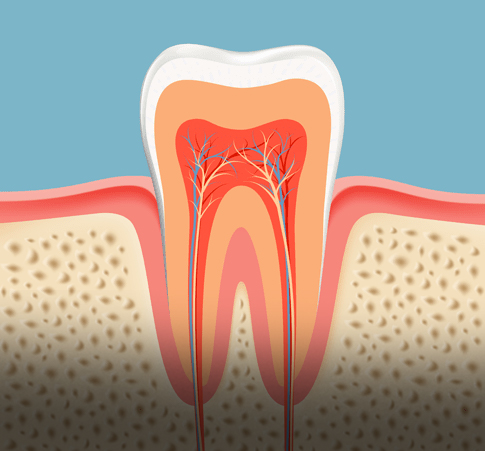 Treatment - Kettering Dental