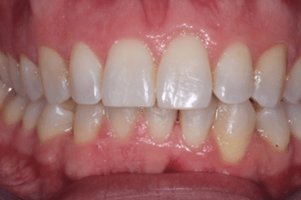 After - Kettering Dental