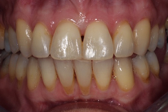 After - Kettering Dental