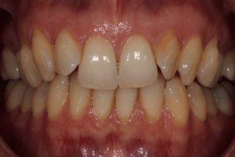 Before - Kettering Dental