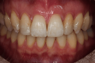 After - Kettering Dental