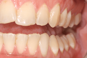 After - Kettering Dental