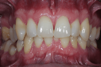 Before - Kettering Dental