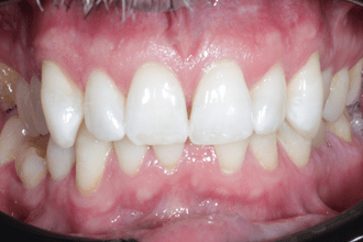 After - Kettering Dental