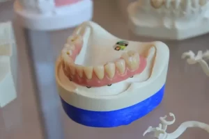 Denture on on a blue and white holder on a transparent table