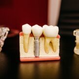 Dental Implant, on the table.