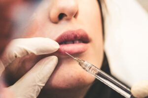 doctor filling patient's lips