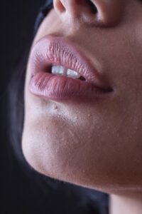 Women's pink lips after lip filler treatment