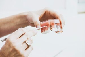 dental implants being held